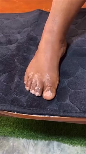 Share Usefultips on Instagram: "Follow @share_usefultips usefultips for more helpful tips like this one! Eliminate Nail Fungus with This Powerful Lemon Trick! A nail care expert taught me this, and my nails have never looked better! Just mix 3 tablespoons of baking soda, the juice of 1 lemon, and 3 tablespoons of white vinegar. Dip a lemon peel into the mixture and rub it on each nail for 3 minutes-this removes fungus, strengthens, and hydrates! Let it sit for 5 minutes before rinsing. Special s