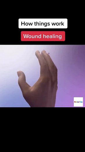 Exploring the Process of Skin Wound Healing