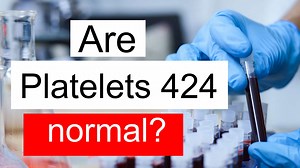 Treatment and symptoms of Platelet count 424 thou/uL | Diet for normal Platelet count level 424 thou/uL