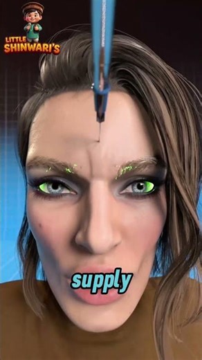 one injection and you go blind #shorts #filler #cosmetics