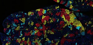 Every cancer is unique – why different cancers require different treatments, and how evolution drives drug resistance