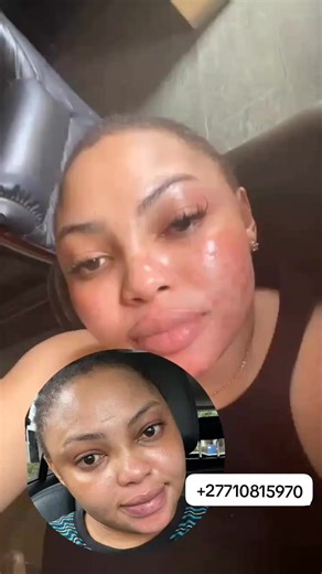 SOFIA SKIN LIGHTENING CREAM WHATSAPP US 27710815970