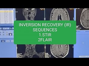 MRI Inversion Recovery sequences Stir and Flair ko kese phchane @Mri stir sequences or flair seq