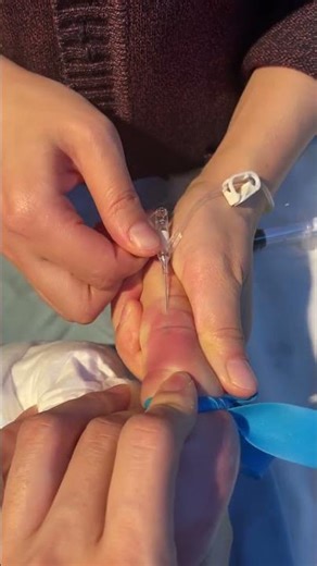 Brave Little Hero: Pediatric IV Placement Explained 🩺👶