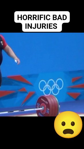 HORRIFIC BAD INJURIES TURNS CAREER-END OF THE ATHLETEs #badinjuries #bonecrack #athlete #viralvideoシ #mixtvphilippines | Mix TV Philippines