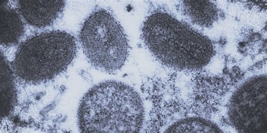 This Day in History: Smallpox declared eradicated