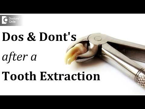 Dos and Dont's after a tooth extraction - Dr. Sathyadeep. V