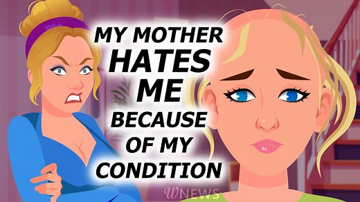 266K views · 6.7K reactions | A model with alopecia ended up embroiled in a scandal because of her wig | Wnews Video | Facebook