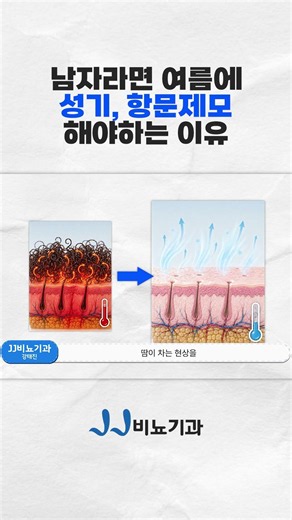 여름에 남자가 성기, 항문제모가 필요한 이유 #Shorts