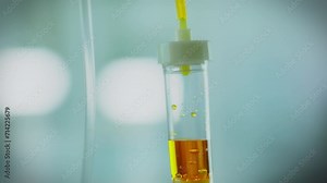 A close-up shows how the medicinal liquid drips from the bag, filling the iv drip system. The infusion moves through clear tubes to ensure even distribution of the medication