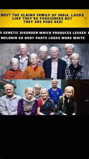 The Albino Family Of India | Looks Foreign But Truly Desi 🇮🇳 | Rare Genetic Story #amazingworlds