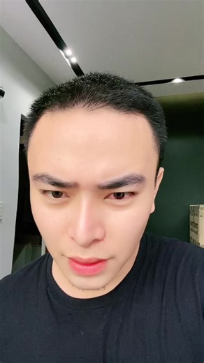 What should I do first? Woke up with reddish right eye