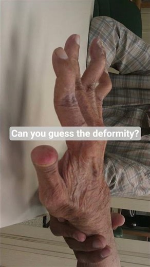 #shortsvideo #shorts #aiapgetpreparation