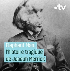 5.5M views · 4.5K reactions | Traité comme un monstre de foire à cause de sa maladie, Joseph Merrick connut une vie tragique et un surnom qui le suivit toute sa vie, Elephant Man. | France tv culture | Facebook