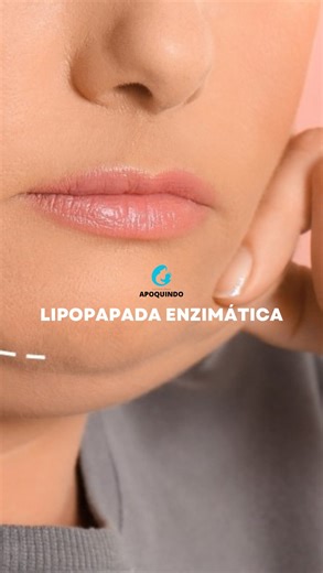 Clínica Láser Apoquindo on Instagram: "✨Con nuestra Lipopapada enzimatica de BCN Adipo lograremos eliminar esa grasa localizada de la mejor manera sin procedimientos invasivos"