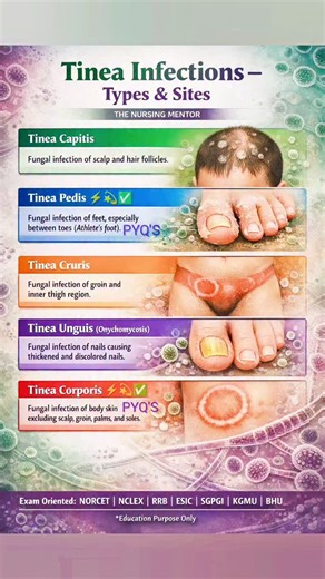 THE NURSING MENTOR on Instagram: "🦠 Tinea Infections (Dermatophytosis) – Theory 📌 Definition Tinea infections are superficial fungal infections caused by dermatophytes (Trichophyton, Microsporum, Epidermophyton). They affect keratinized tissues such as skin, hair, and nails. 📍 Types of Tinea & Affected Sites 🔹 Tinea Capitis Infection of scalp and hair follicles Common in children 🔹 Tinea Pedis (Athlete’s Foot) ✅PYQ'S ✅ Infection of feet, especially between toes 🔹 Tinea Cruris (Jock Itch) I