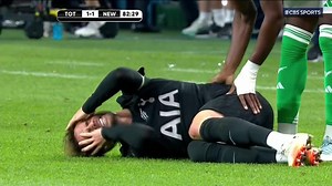 1.3M views · 8.5K reactions | HEARTBREAK for James Maddison, who is forced off the pitch on a stretcher after just returning from injury for Spurs 洛 Get well soon James ❤️ | CBS Sports Golazo | Facebook