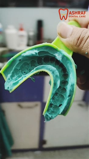 Full Process Of RCT & Cap