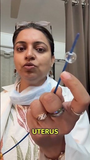 What is an HSG Test? | Hysterosalpingogram Procedure Explained