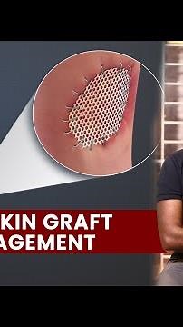 Post Skin Graft Management | Dr. Sree charan