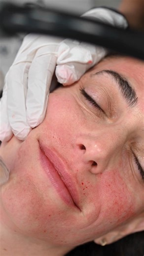 Renew MD Medical Spa on Reels