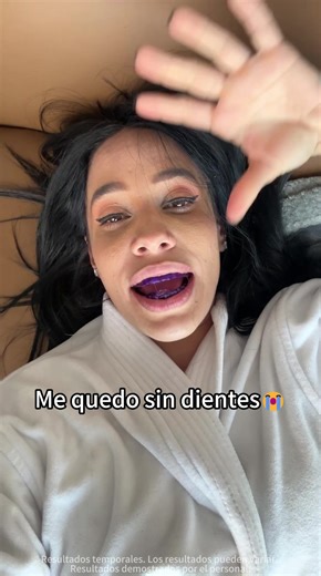 YOUR TEETH ARE AS YELLOW AS CORN???#badbreath #teethwhitening #coffeelovers #yellowteeth #teethstrips