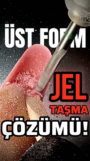 Jel Taşma Sorunu ve Çözüm Yöntemleri