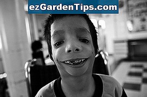 Qu'est-ce que l'herbicide Treflan? 🌱 Conseils Jardiniers - Fr.ezGardenTips.com