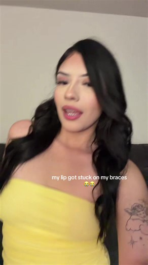Lip Stuck on Braces Mishap