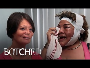 5 Touching & Emotional Patient Stories on "Botched" | Botched | E!