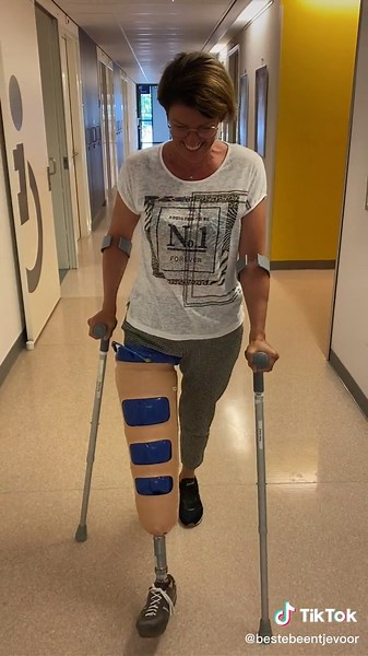 Walking with Crutches and Airboot: My Journey as an Amputee