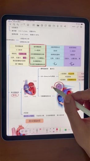 思维导图小技巧 —— 手写笔记绑定卡片 在白板中制作思维导图的时候，经常会使用笔画重点，手写备注。但导图新增节点后，手写笔记与导图节点就错位了。这是因为白板中书写的手写笔记属于白板，不属于导图节点。我们可以使用绑定卡片功能，让手写笔记绑定到指定的卡片上。这样就不会错位了。#ipad无纸化学习 #ipad笔记 #BoardNotes #iPad手写 #思维导图软件