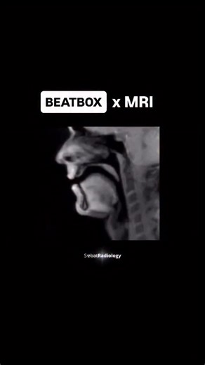 Best Beatmakers World on Instagram: "Watch a beatboxer’s anatomy in action. 🎤🔬 This MRI reveals the insane high-speed choreography inside a beatboxer’s body. Sound visualized like never before. Incredible work by @sobatradiology & @timo.schnepf 🤯 Where music meets science. → @beastbeatmakersworld #mri #beatbox #science #anatomy #innovation #sobatradiology #beastbeatmakersworld"