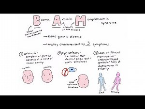 Bosma arhinia microphthalmia syndrome (BAM syndrome)