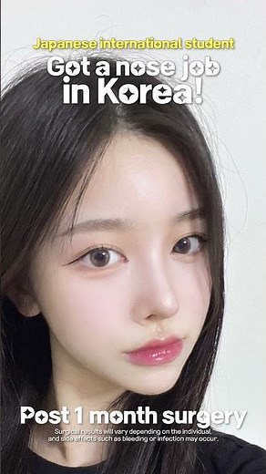 Rhinoplasty in Korea, Asian Nose Job Recovery Time, Before and After #koreanplasticsurgery