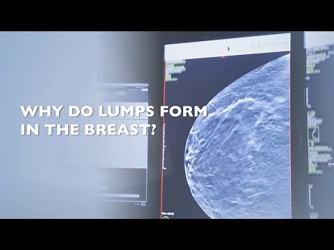 What To Do When You Find a Lump in Your Breast?