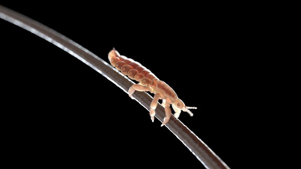 CDC guidelines: Students with lice no longer need to be sent home early