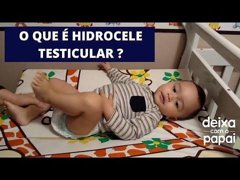 HIDROCELE TESTICULAR: PRINCIPAIS CAUSAS E TRATAMENTO/ DEIXA COM O PAPAI