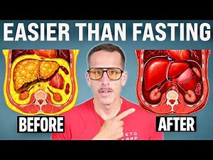 I Reversed My Fatty Liver Fast - Try These 3 Things Today!