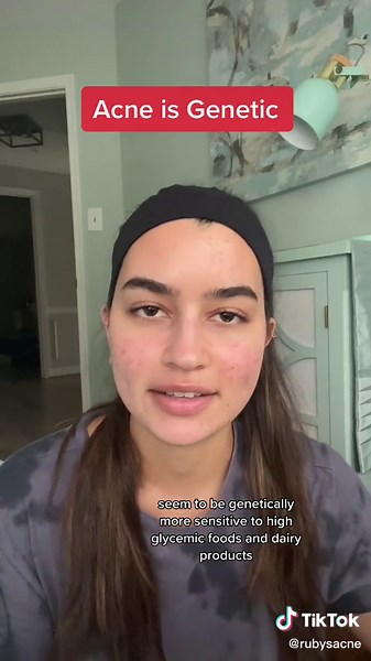 Understanding Acne: Genetics, Research, and Treatment