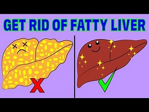 How to reverse a fatty liver naturally