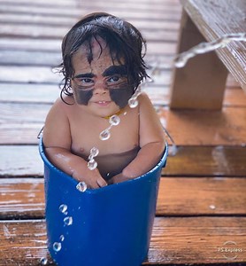 124K views · 362 reactions | Luna's skin condition affects one in 20,000 newborns but it hasn't affected her will to be a happy kid! 戮❣️ Learn more here: https://bit.ly/36GKIKv For more: https://helpluna.com/collections/all Instagram: @luna.love.hope | In The Know Parenting | Facebook