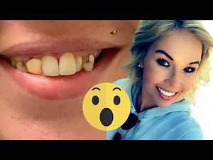 "I Haven't Smiled In 17 Years. I Just Want To Smile Again"