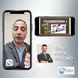 📢EXCITING NEWS📢 Todd Ponsky, MD and the Stay Current: Pediatric Surgery app are excited to introduce Dr. Tamer Ashraf Pediatric Surgeon from Mansoura University Children's Hospital, Egypt. Dr. Ashraf has created an incredible library of open pediatric surgery technique videos that will now be available on the StayCurrent in Pediatric surgery app. This week, we are releasing the “Circumcision (Gomco Clamp)”. Full video here on the Stay Current: Pediatric Surgery app: https://staycurrentapp.app.
