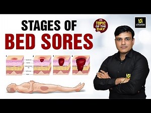 Stages of Bed Sores | Important Topic for NORCET & Other Nursing Exams | Shailendra Sir