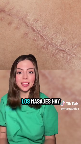 Cuidado de Cicatrices: Tips para una Piel Saludable