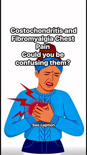 79K views · 655 reactions | Costochondritis and Fibromyalgia - Could...