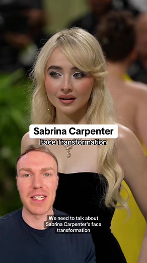 Sabrina Carpenter's Stunning Face Transformation Revealed