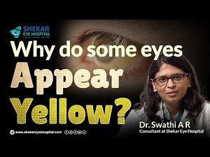 Why Are Your Eyes Turning Yellow? Causes, Symptoms, and When to See a Doctor? | Shekar Eye Hospital