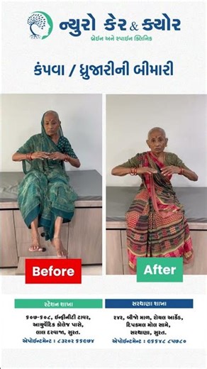 This patient was suffering from severe hand tremors, making even simple tasks impossible.